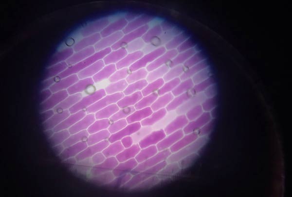 Cells Alive! Year 12 Biologists observe osmosis, plasmolysis and turgor in Red Onion Epidermis!